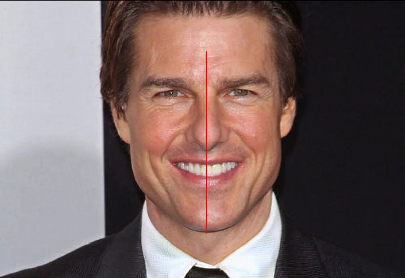 Tom Cruise Before Dental Work