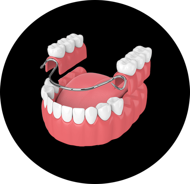 Partial Dentures