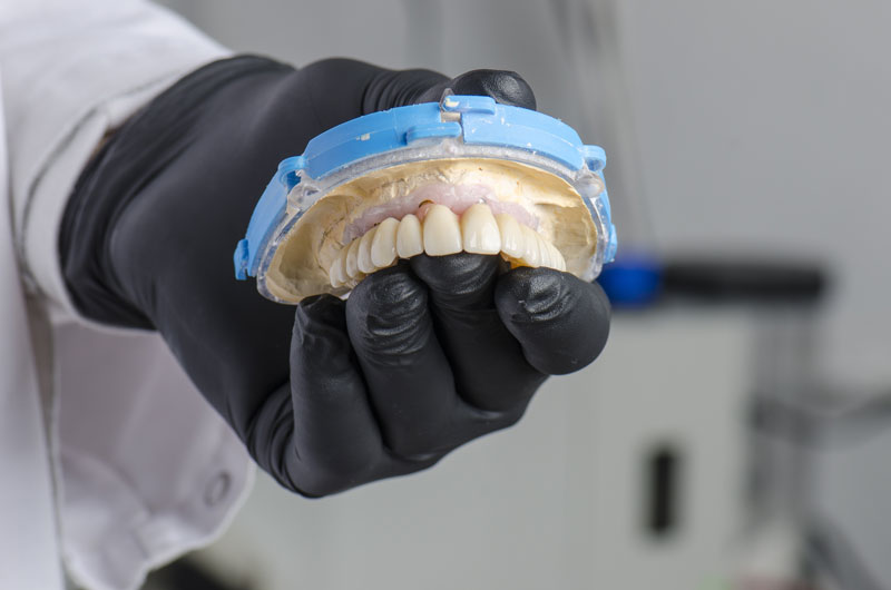 dentist holding full arch dental implant model