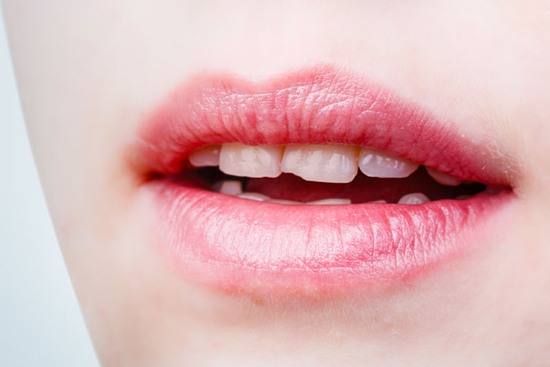 Dental Patient With Chipped Teeth