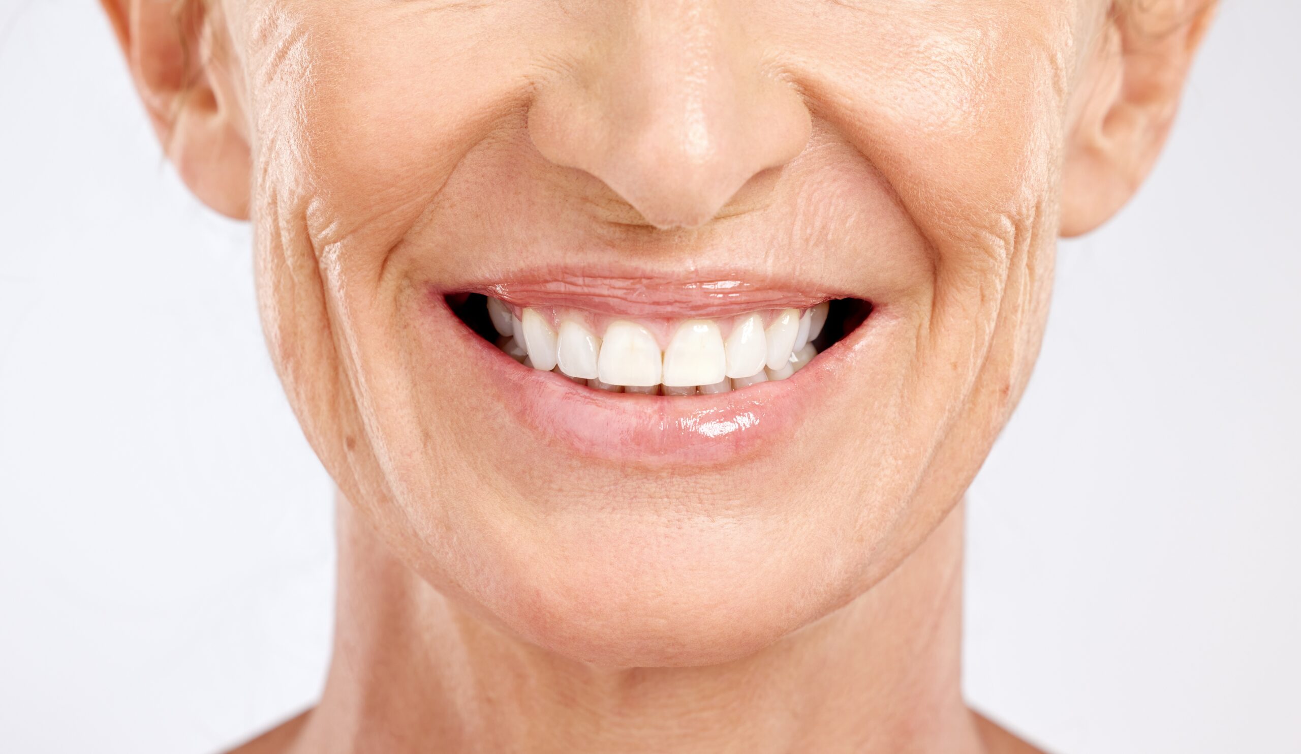 an image of a dental patient getting porcelain veneers.