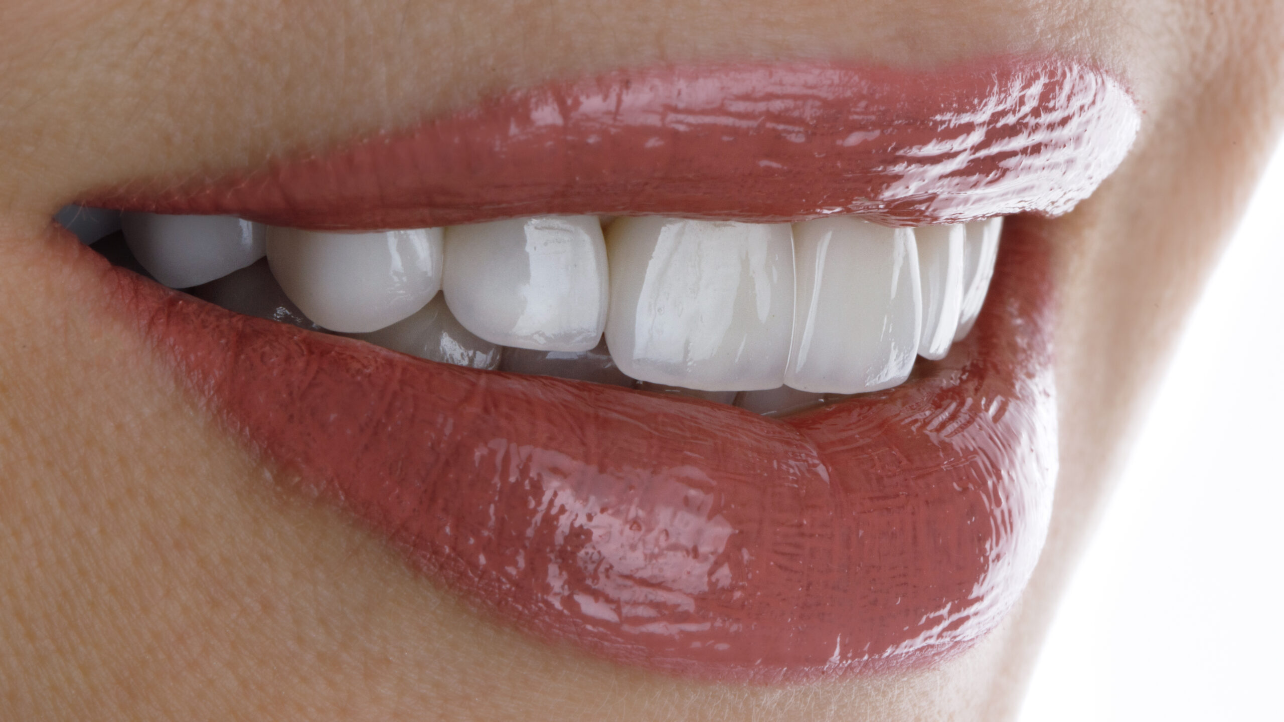 perfect smile of a girl with veneers and beautiful lipstick.