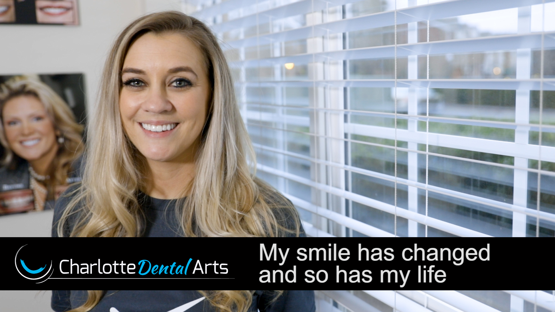 Jenna's Smile Makeover: A thumbnail snapshot capturing Jenna’s emotional and transformative journey with Dr. Porter at Charlotte Dental Arts, highlighting her joyful, confident smile.