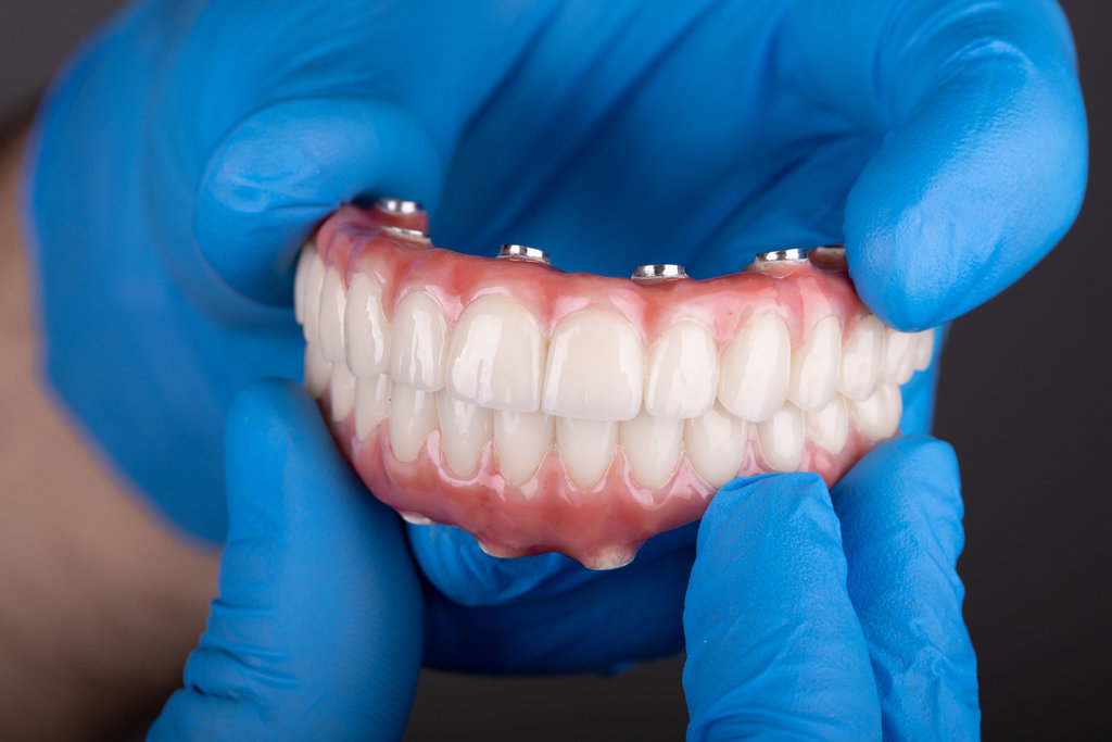 Revolutionize Your Smile with All-On-X Permanent Teeth: Stunning Photos for Adobe Stock