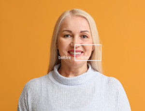 Happy mature woman before and after smile makeover procedure on color background