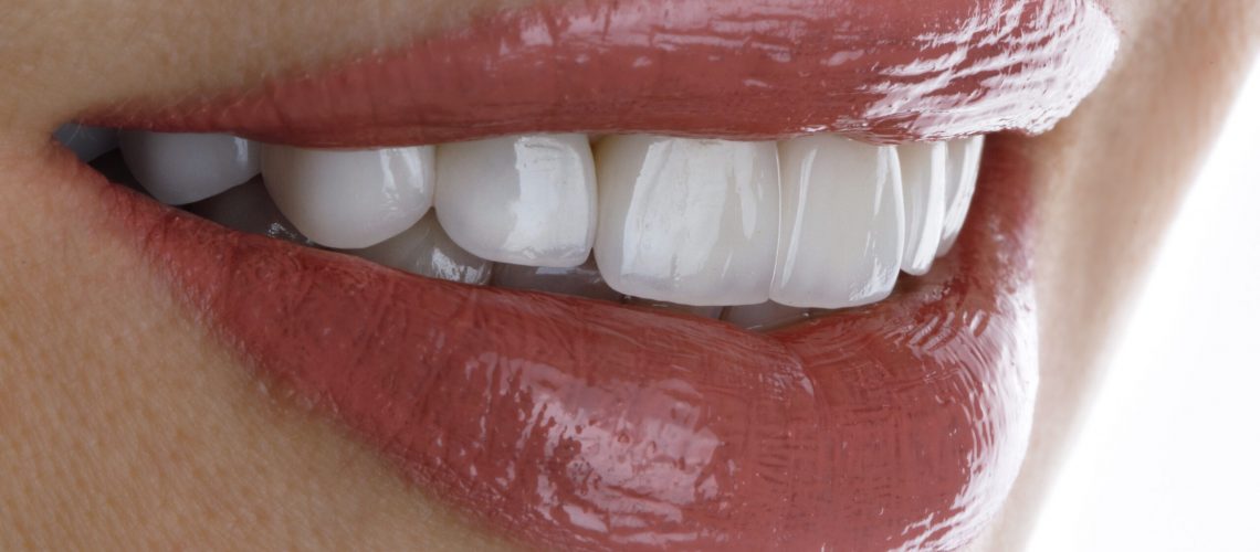 perfect smile of a girl with veneers and beautiful lipstick.