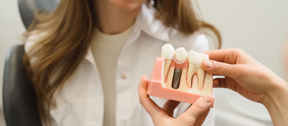 Dental Patient Getting Shown A Dental Implant Model During Her Consultation in Charlotte, NC