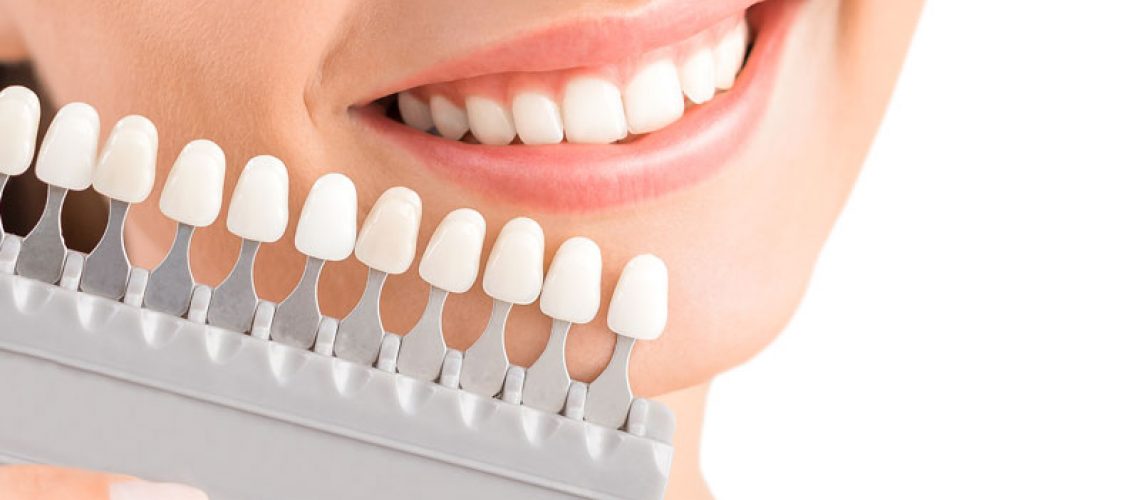 dental implant patient holding up veneers rack