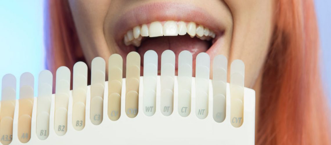 a dental patient smiling after recieving new dental veneers