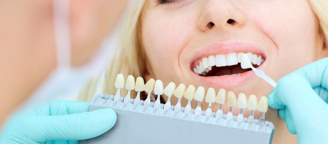 a picture of a patient smiling as the doctor is placing her custom made porcelain veneers on her teeth.